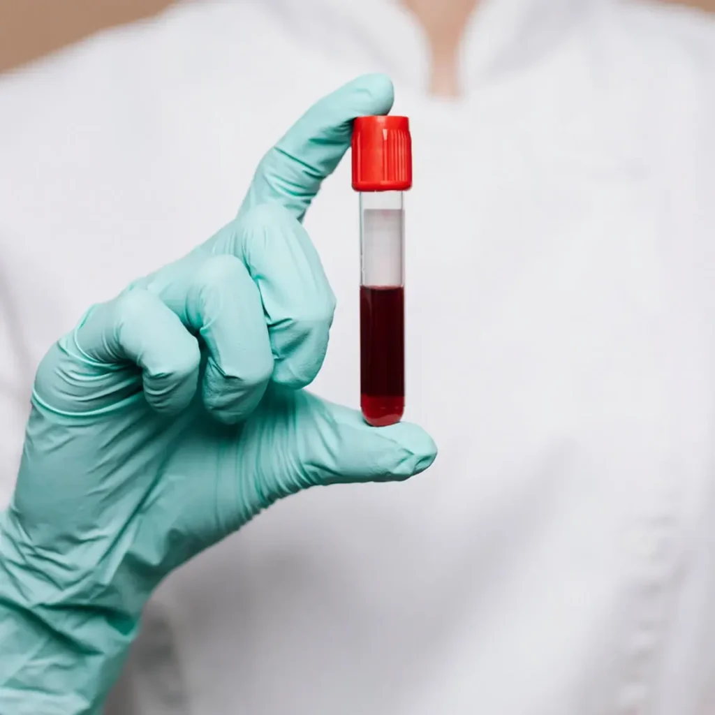 Close-up of a gloved hand holding a test tube with red liquid, against a blurred white background.